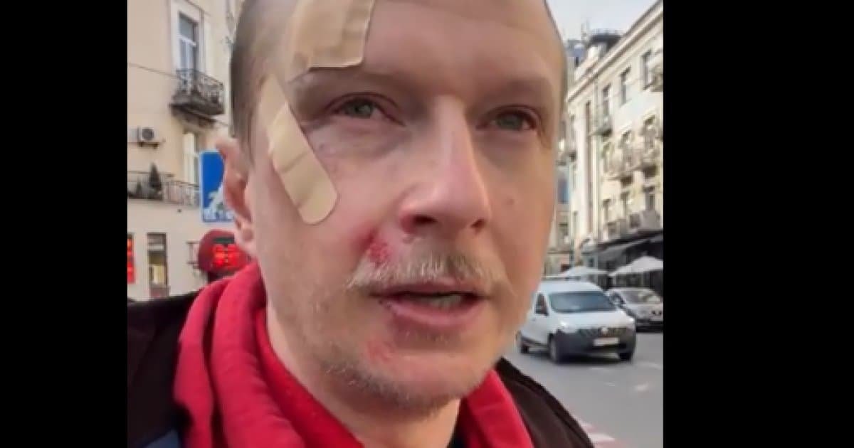 В Киеве избили тележурналиста, известного как Майкл Щур 1