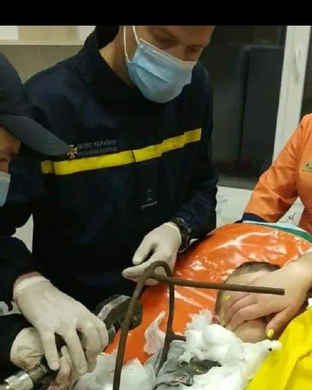 Играл во дворе и накололся на ножку стула: в Полтаве врачи спасают мальчика 1
