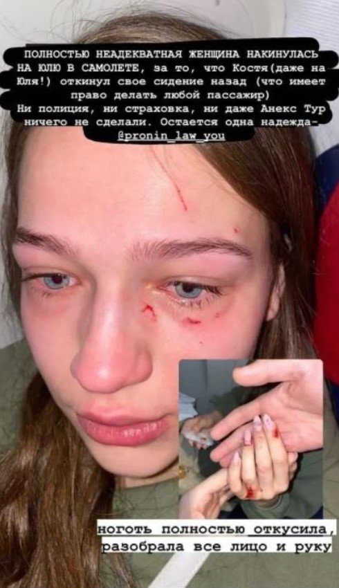 Откушен ноготь и расцарапано лицо: в самолёте в Доминикану подрались украинские туристы 2