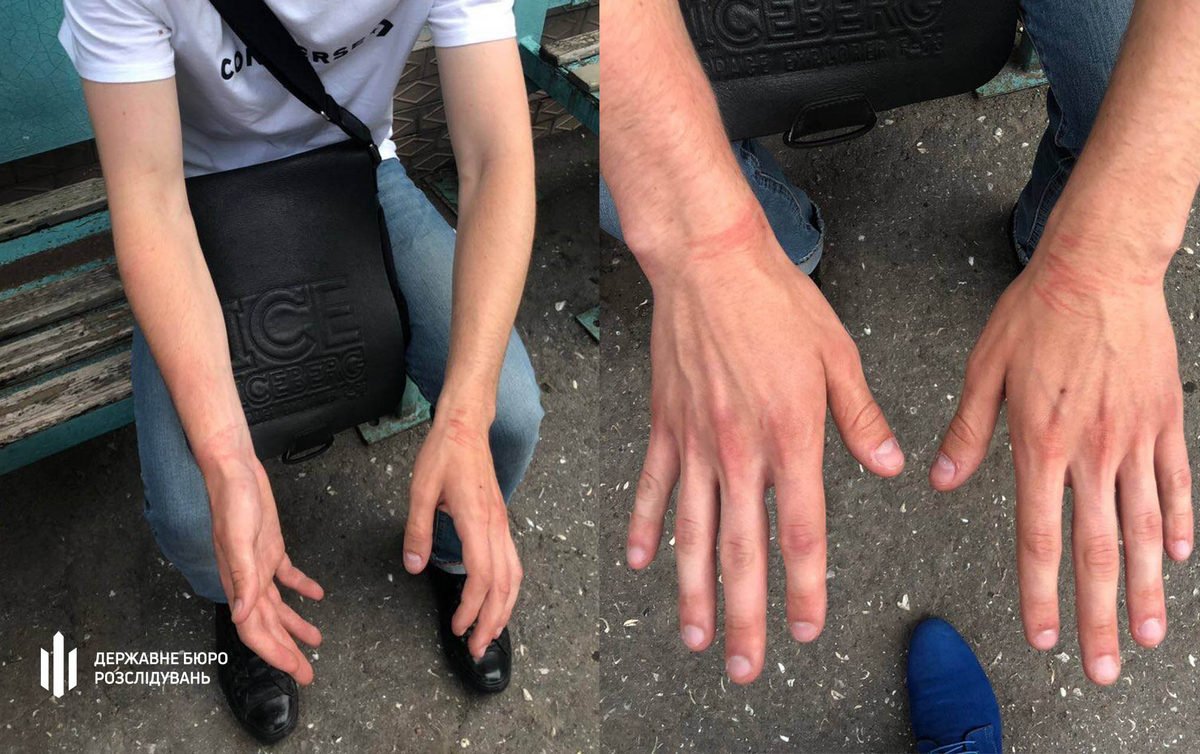 Патрульный избил подростка