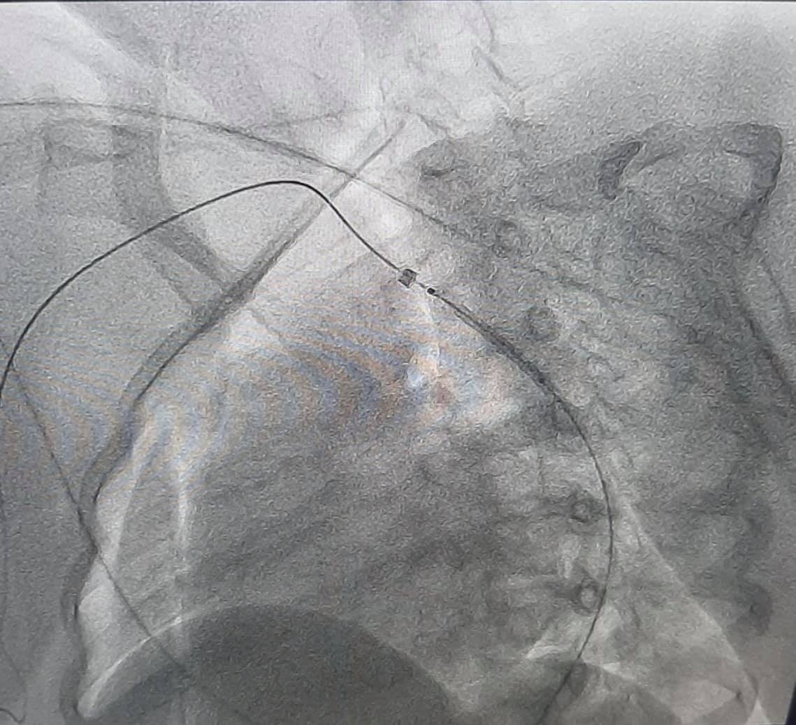 Впервые в Украине провели операцию с помощью виртуальной реальности 3