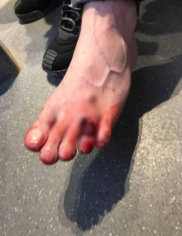 У Харкові помічник нардепа СН Куницького влаштував стрілянину на парковці: поранено людину 3