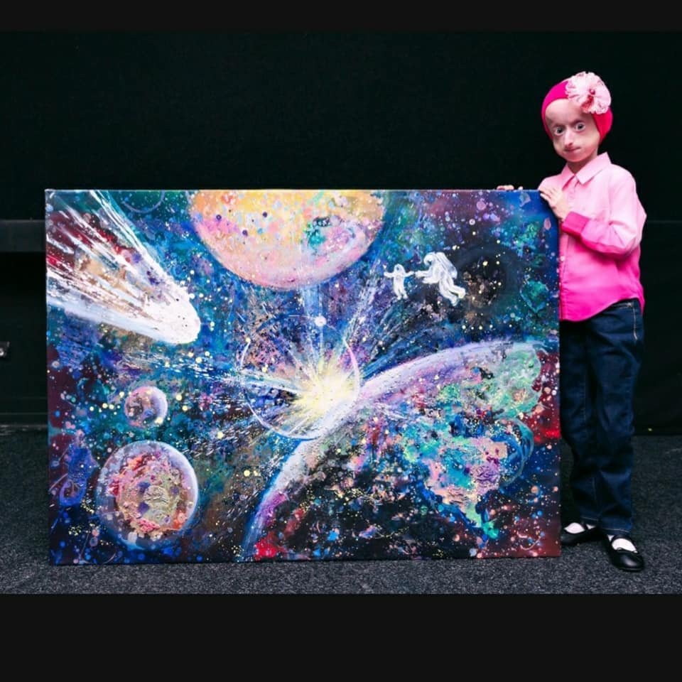 В Украине умерла 10-летняя девочка с редчайшим синдромом преждевременного старения 1