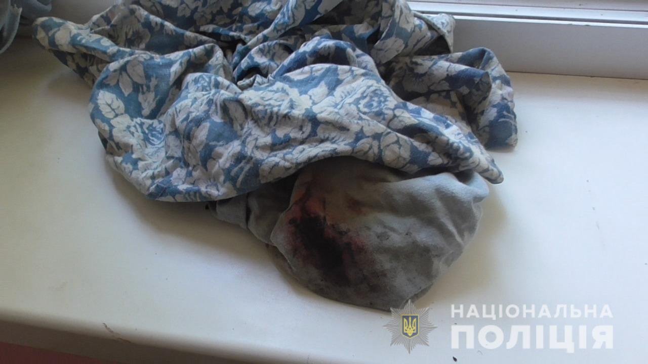 В Одессе мошенники заманили мужчину в квартиру: ему сломали челюсть и ограбили 1
