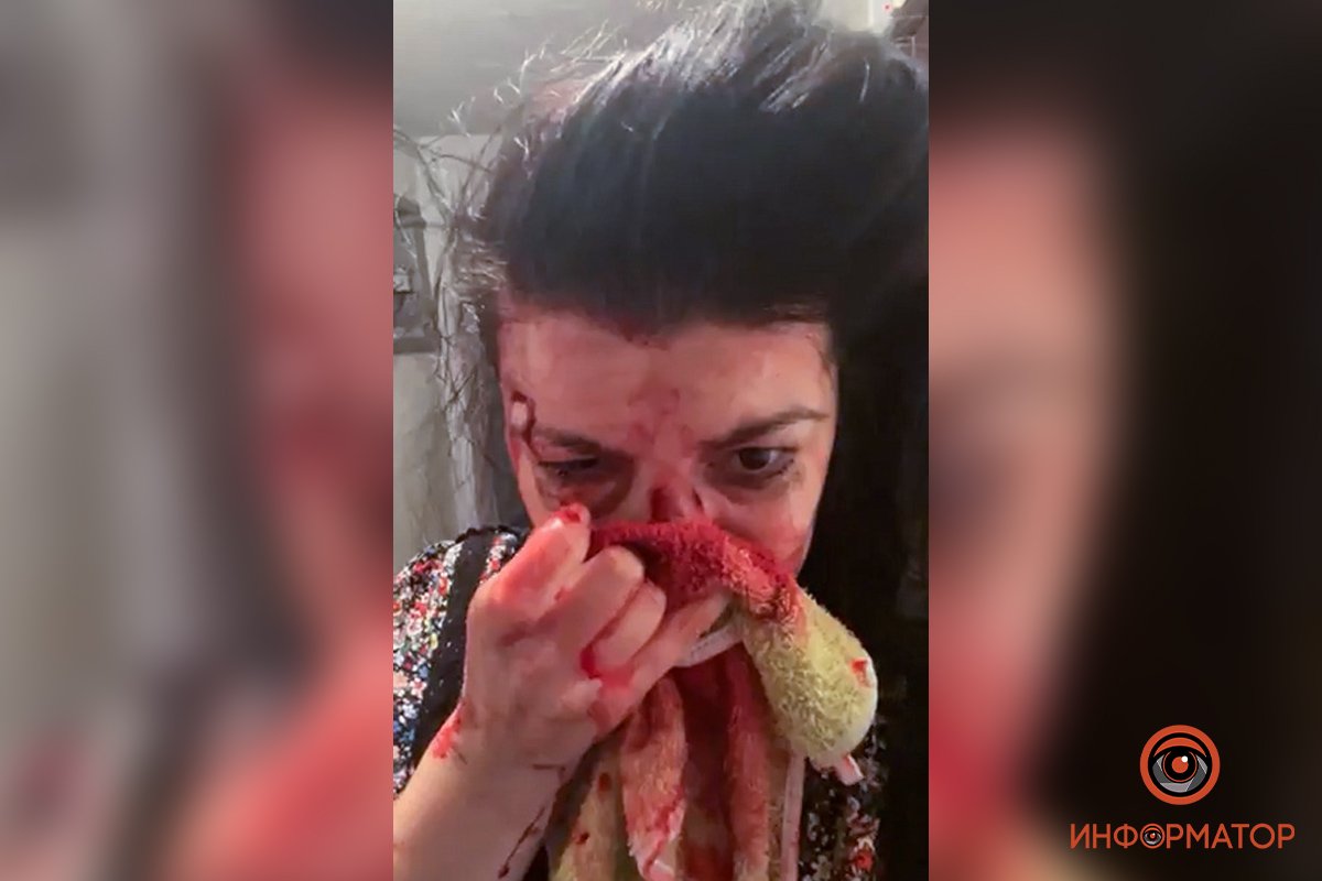 В Днепре двое мужчин жестоко избили активистку в подъезде её дома. Мэр Филатов обратился к Монастырскому 1