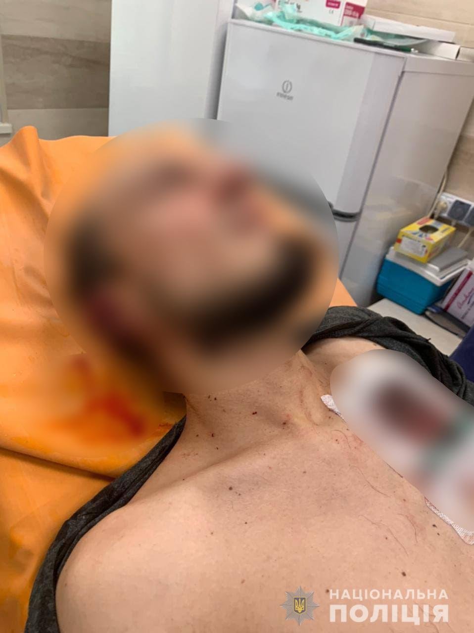 У Черкаській області під час конфлікту чоловік кілька разів вистрілив в опонентів: двоє поранених 2