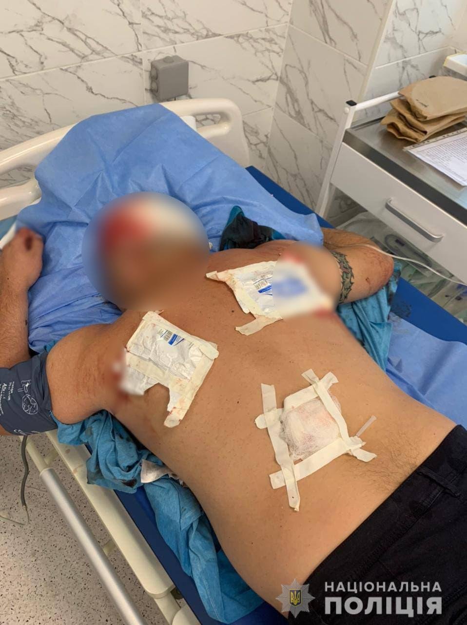 У Черкаській області під час конфлікту чоловік кілька разів вистрілив в опонентів: двоє поранених 1