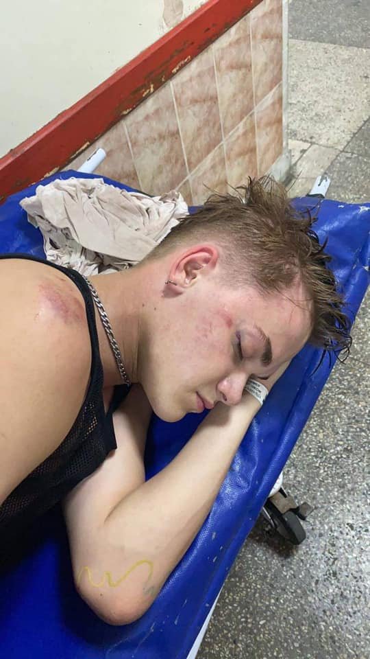 Військового, який побив танцюриста Дорофеєвої в Києві, звільнили з держохорони 1