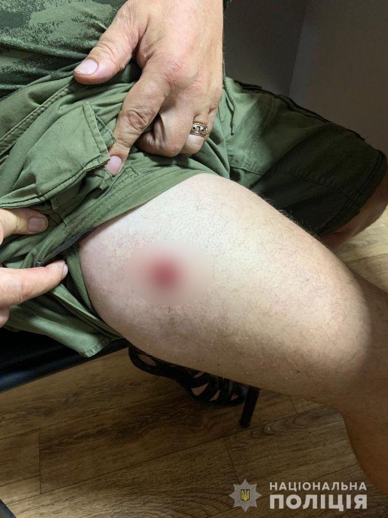 В Киевской области мужчины устроили стрельбу из-за нехватки мест в цирке: есть раненый 1