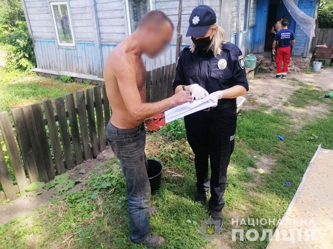 В Черниговской области мужчина облил свою жену бензином и поджёг 2