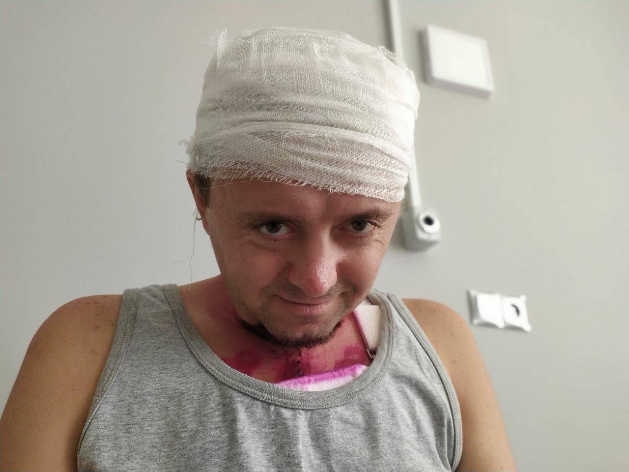 Во Львове напали на мужчину и ударили по голове: врачи 16 дней боролись за его жизнь в реанимации 1