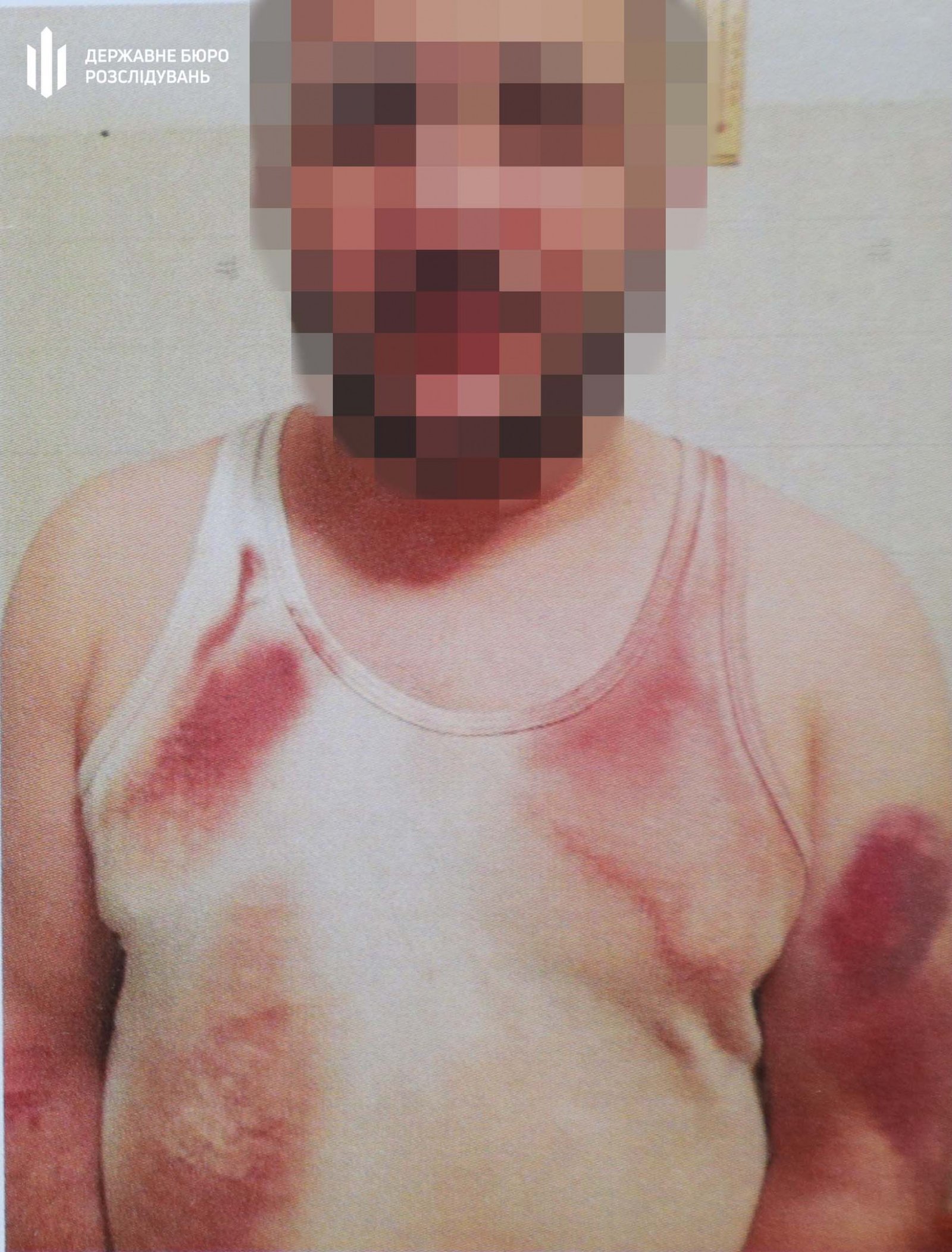 В Киеве двое полицейских пытали подозреваемого ломом 2