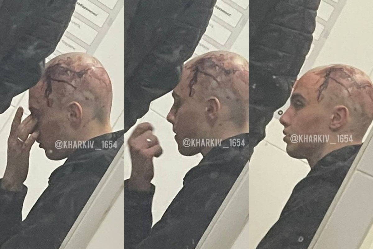 Парня задержали в порядке 208-й статьи УПК Парня задержали в порядке 208-й статьи УПК