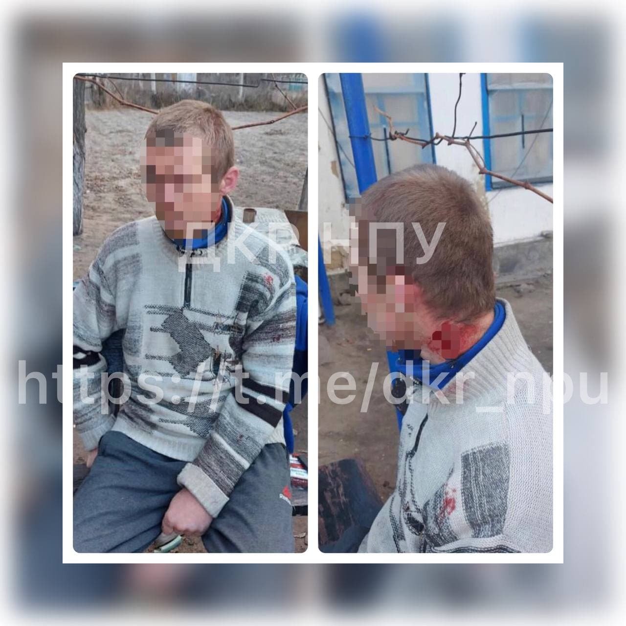 У Херсонській області чоловік зґвалтував дочок своєї співмешканки та намагався зарізати себе 1