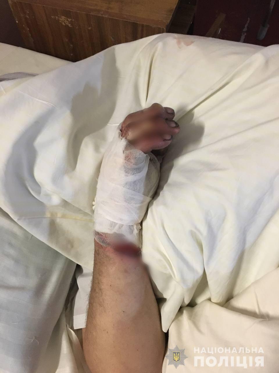 В Белой Церкви мужчины подожгли своего друга за то, что тот не отремонтировал им мопед 1