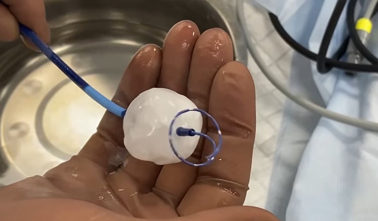 В Україні лікарі вперше "заморозили" серце пацієнта, щоб провести операцію 1