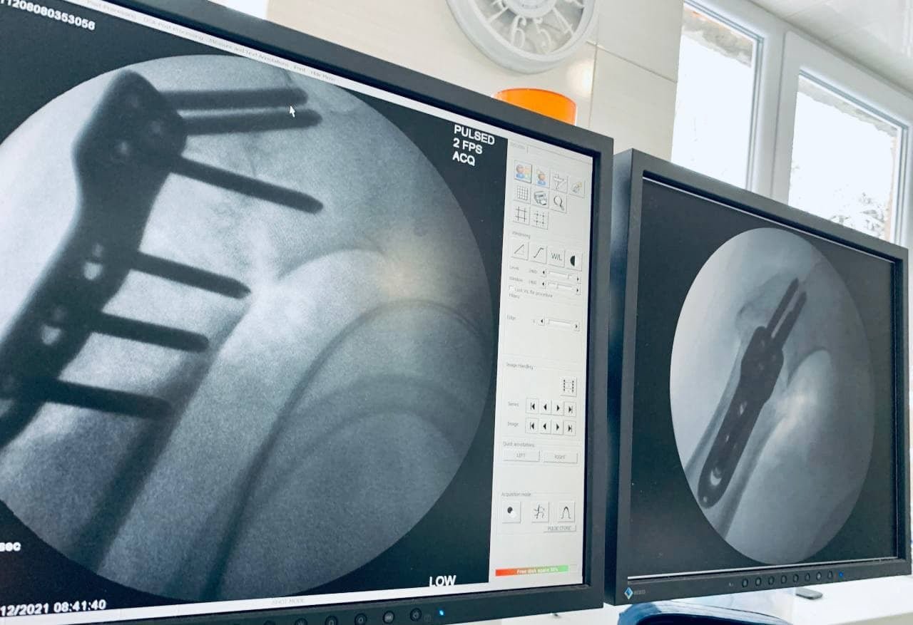 Во Львовской области мужчина 10 лет прожил на чердаке с низким потолком и разучился нормально ходить 3