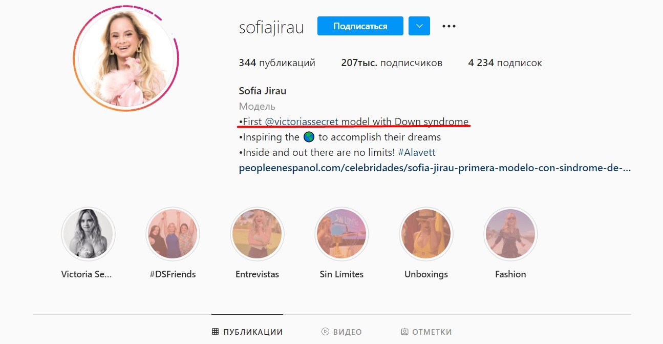 Моделью бренду Victoria's Secret вперше стала дівчина із синдромом Дауна 2