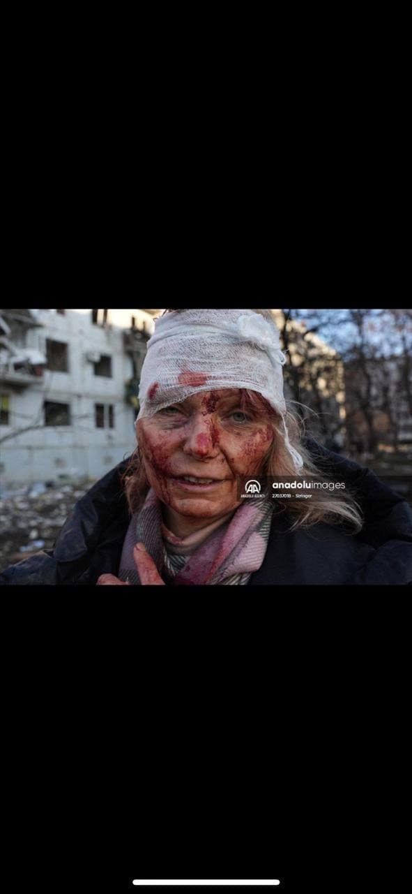 В Чугуеве после обстрелов боевиков загорелась пятиэтажка: погиб ребёнок 4