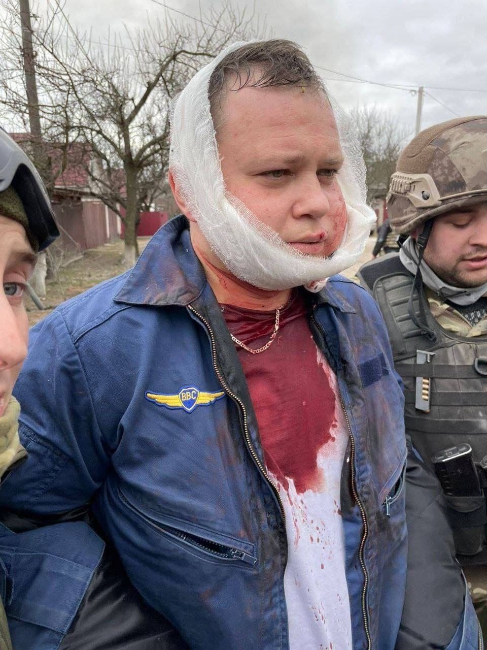 В Чернигове украинские защитники сбили российский самолёт: один пилот погиб, второго задержали 1