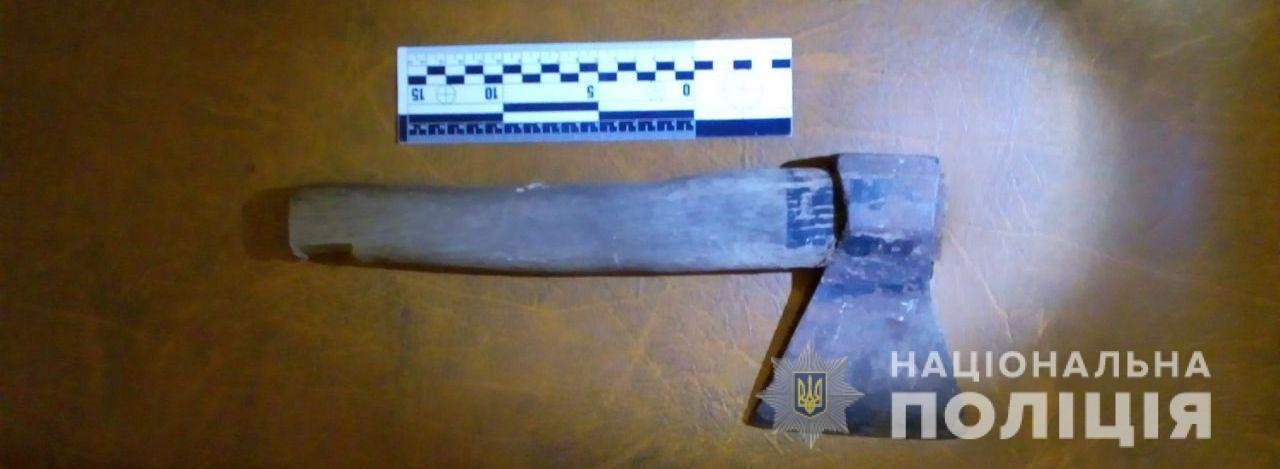 В Одесской области мужчина из-за ревности ударил топором по голове своего соперника: пострадавший в больнице 1