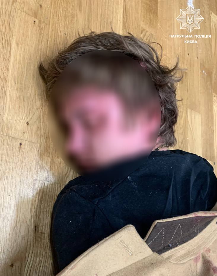 У Києві чоловік кілька разів вистрілив у двох поліцейських: постраждалі у лікарні 1