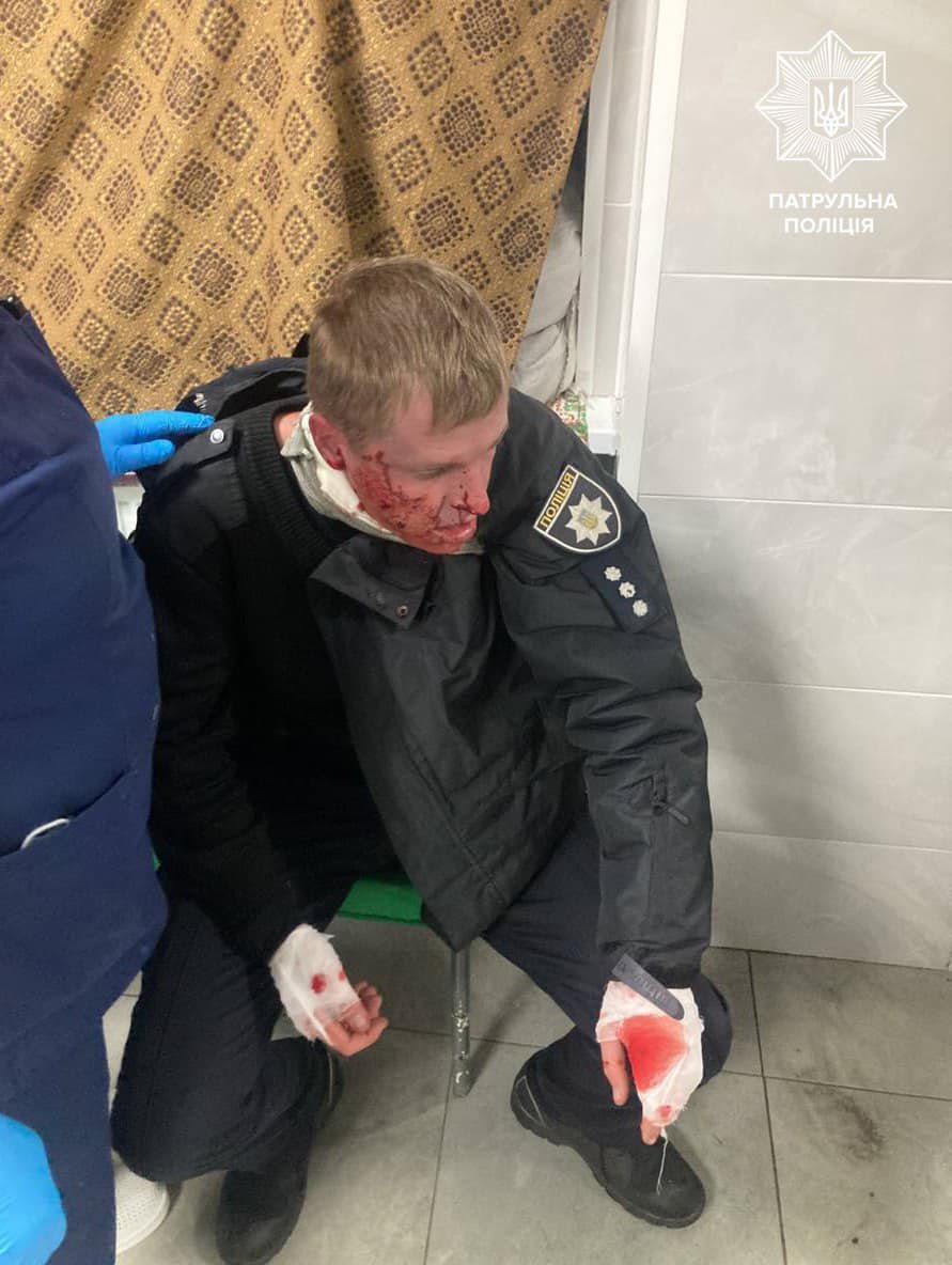 Поранений патрульний