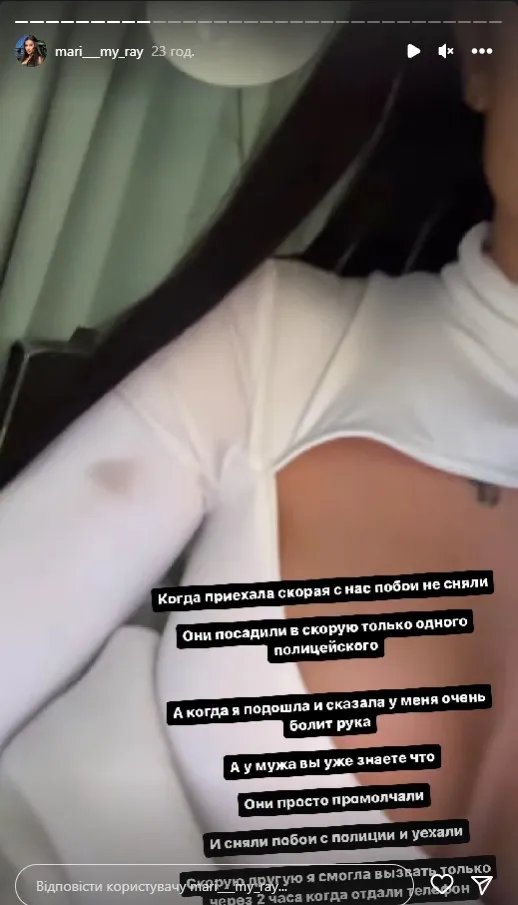 Блогерка показує "побої", які їй завдали патрульні Блогерка показує "побої", які їй завдали патрульні