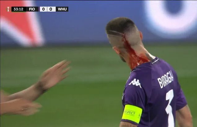 Ліга конференцій "Фіорентина" ˗ "Вест Гем". 10 найяскравіших фото кривавого фіналу 10