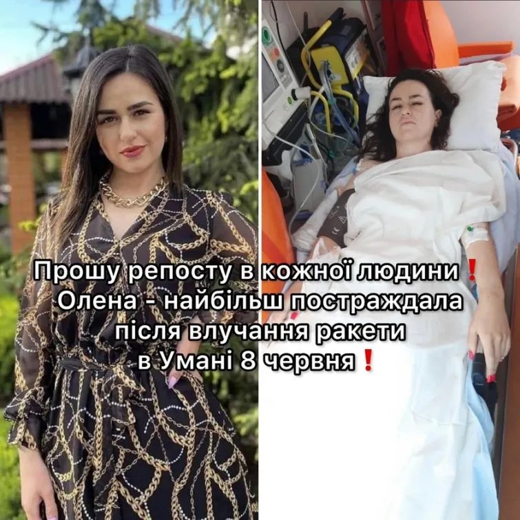 Олена знаходиться у реанімації у вкрай важкому стані