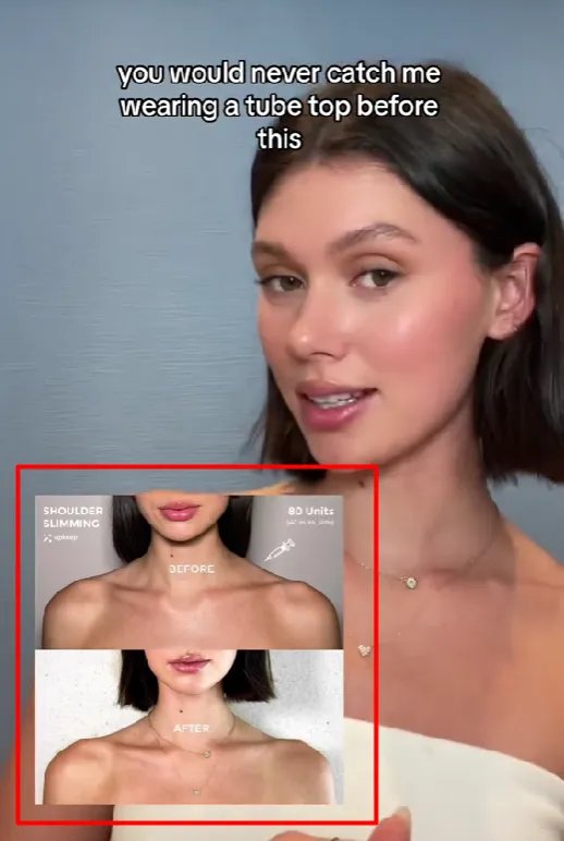 Результат процедуры TrapTox