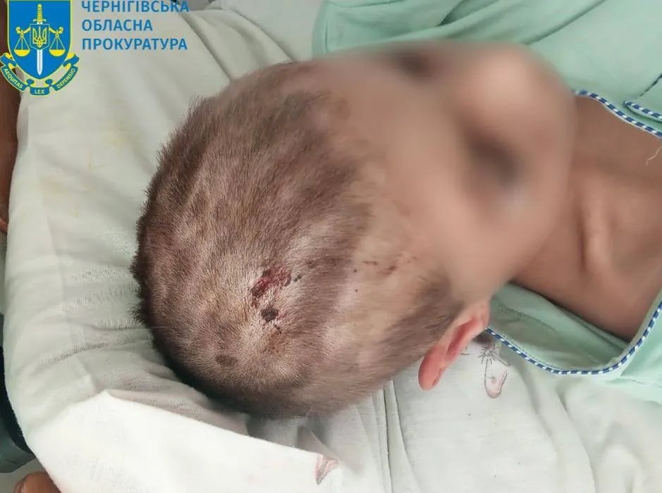 На Чернігівщині чоловік катував жінку та дітей. Фото: Офіс генпрокурора