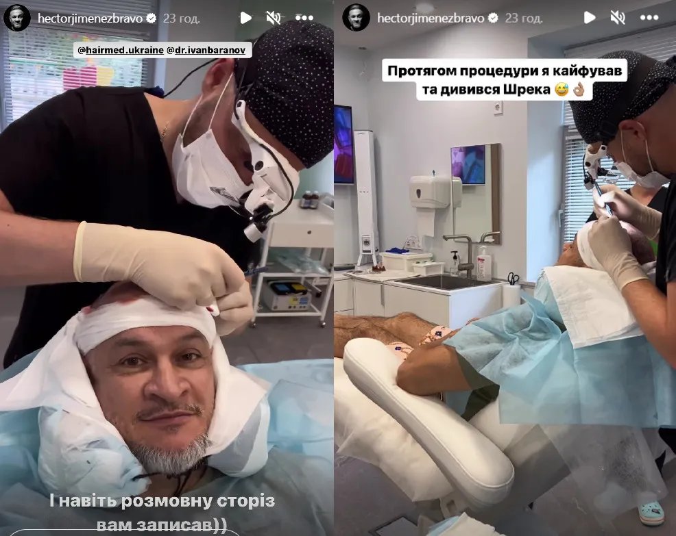 Звездному шеф-повара сделали пересадку волос