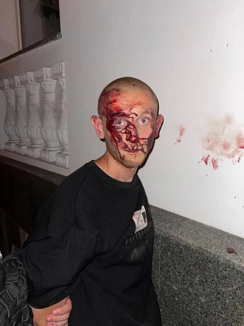 Закривавлене обличччя і кайданки: у Полтаві затримали блогера Заволоку, який систематично конфліктував з місцевою владою та встряг у скандал із - фото 2