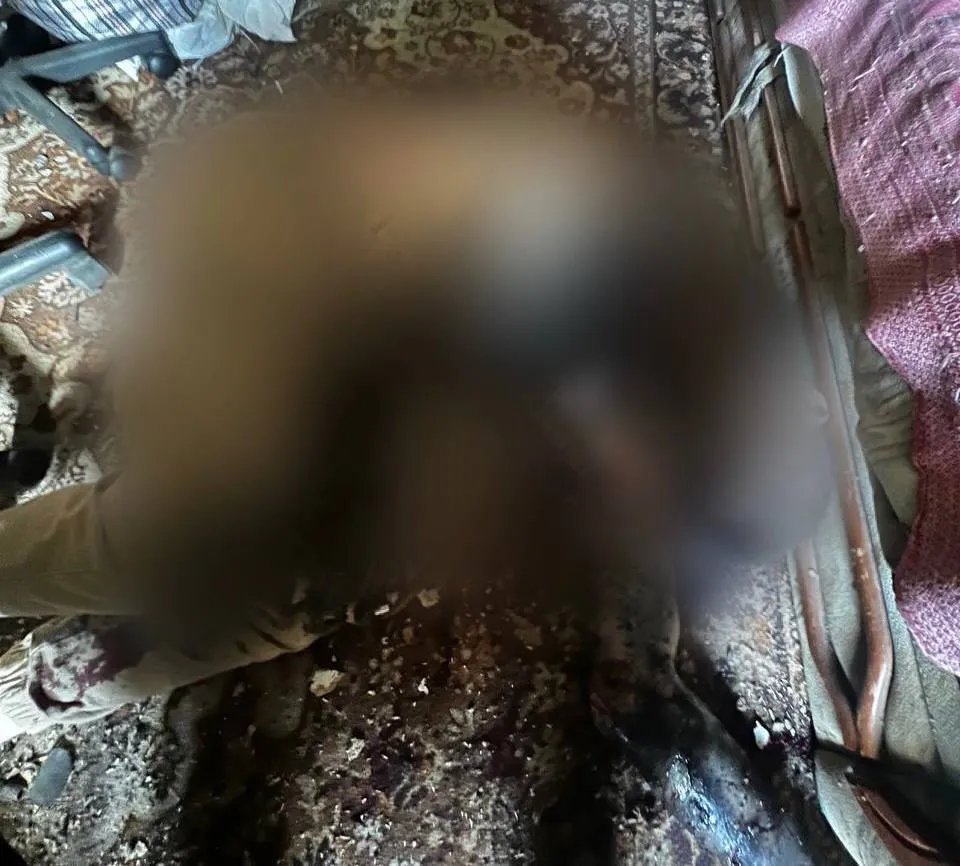На Київщині чоловік підірвав гранату На Київщині чоловік підірвав гранату
