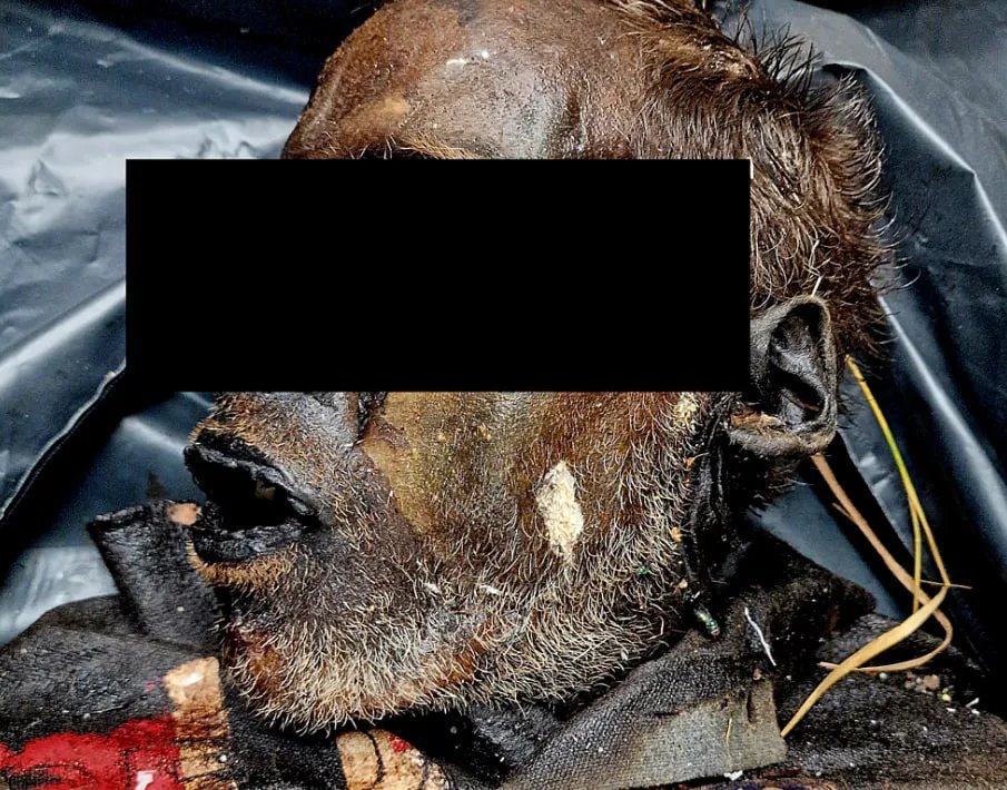 Внешний обзор трупа - мумифицированная кожа лица