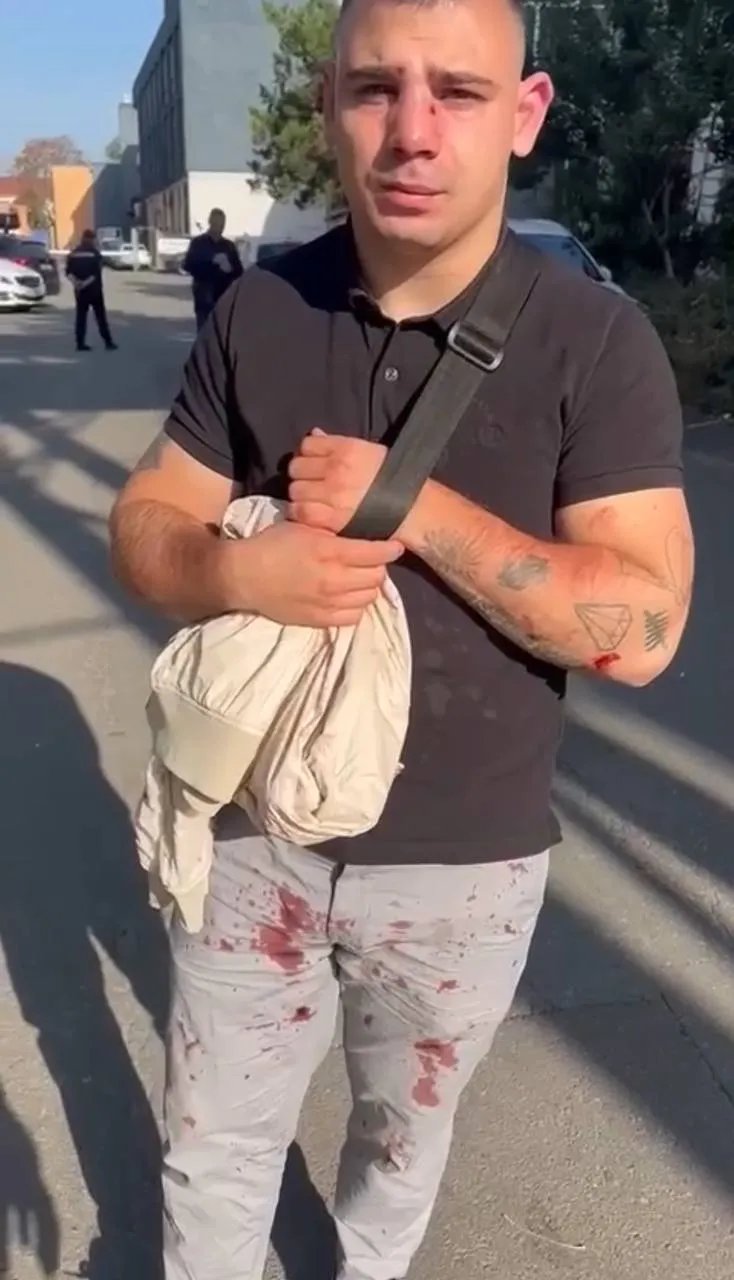 Побитий нардепами киянин