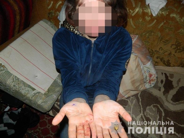 Женщина заступилась за мать и напала на брата Женщина заступилась за мать и напала на брата