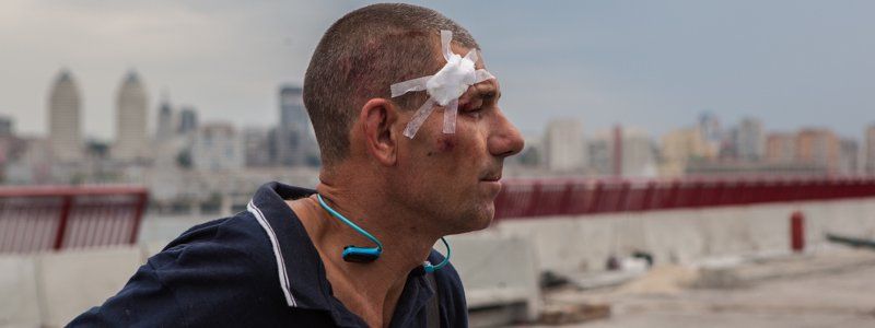 На Новом мосту нетрезвый велосипедист упал и разбил голову
