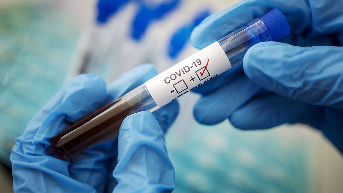 В Днепропетровской области зафиксировали 27 новых случаев COVID-19
