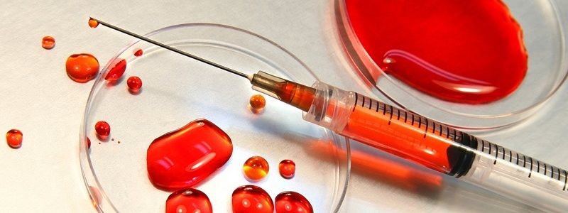 Сколько человек в Днепре и области заражены ВИЧ
