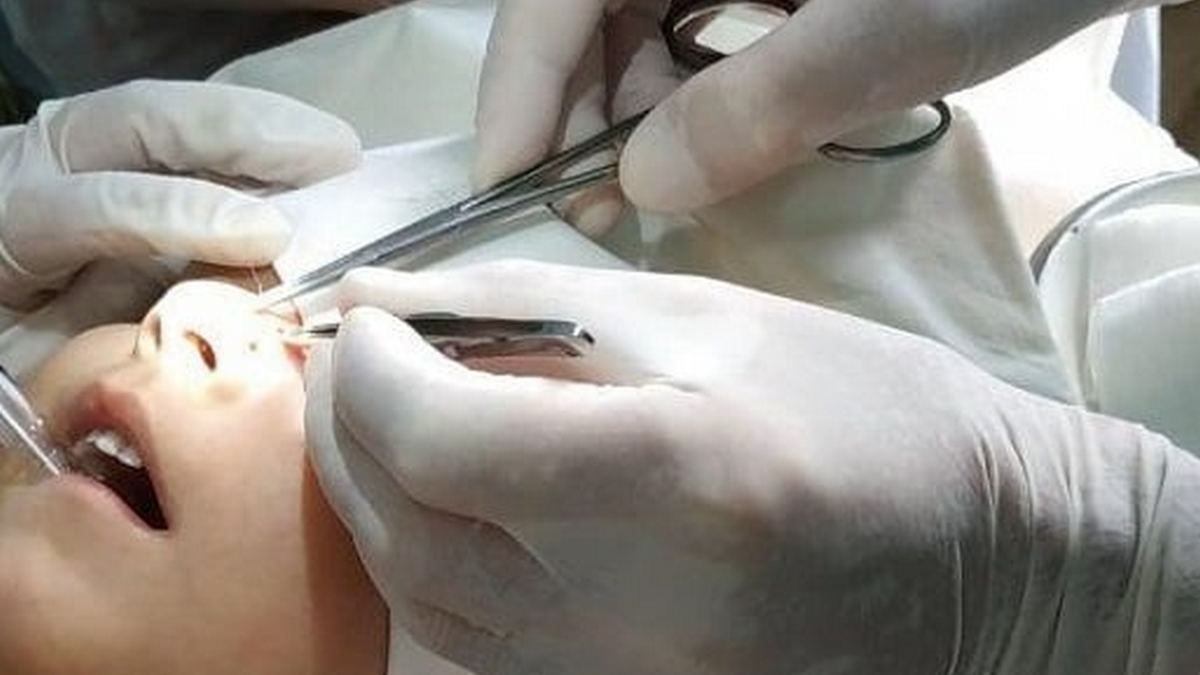 В Днепре 10-летняя девочка упала лицом на острый металлический предмет