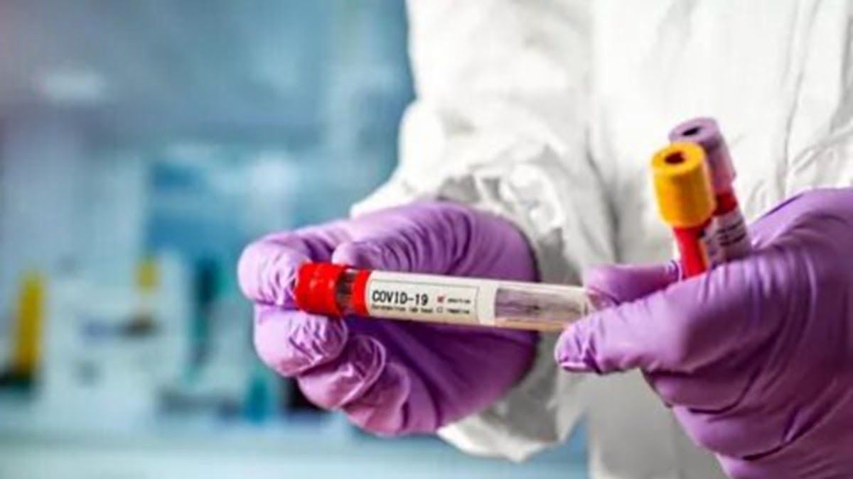 В Украине за сутки подтвердили 2476 случаев заражения COVID-19