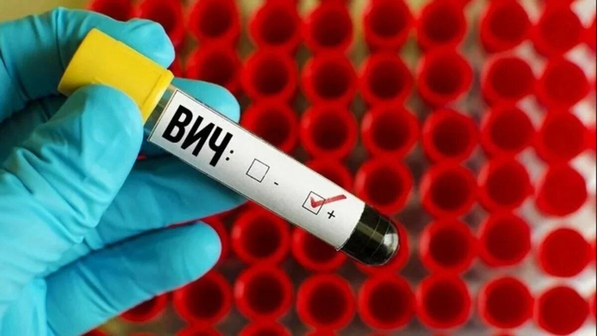 С какими проблемами столкнулись пациенты с туберкулезом и ВИЧ во время пандемии COVID-19