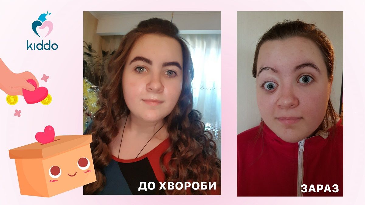 16-летней Элине из Днепра нужна срочная операция