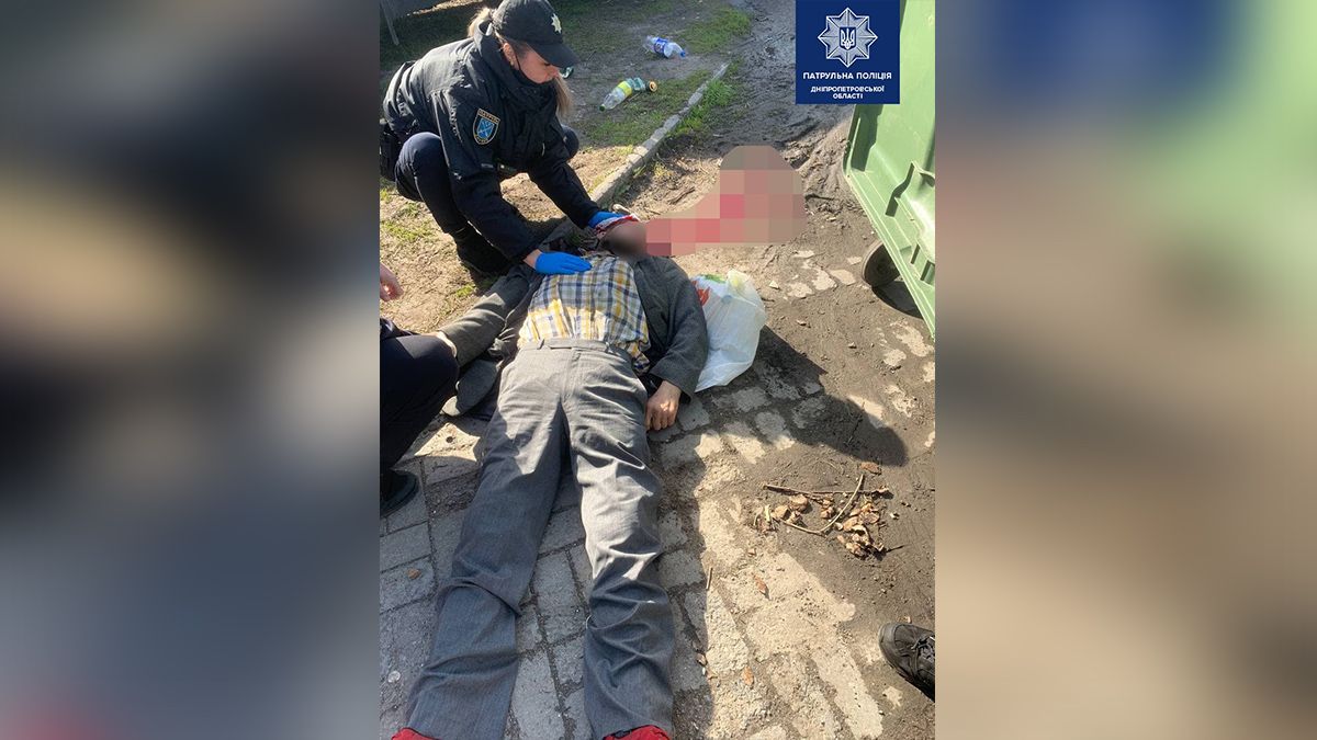 В Днепре у мужчины случился приступ судорог - он упал и разбил голову