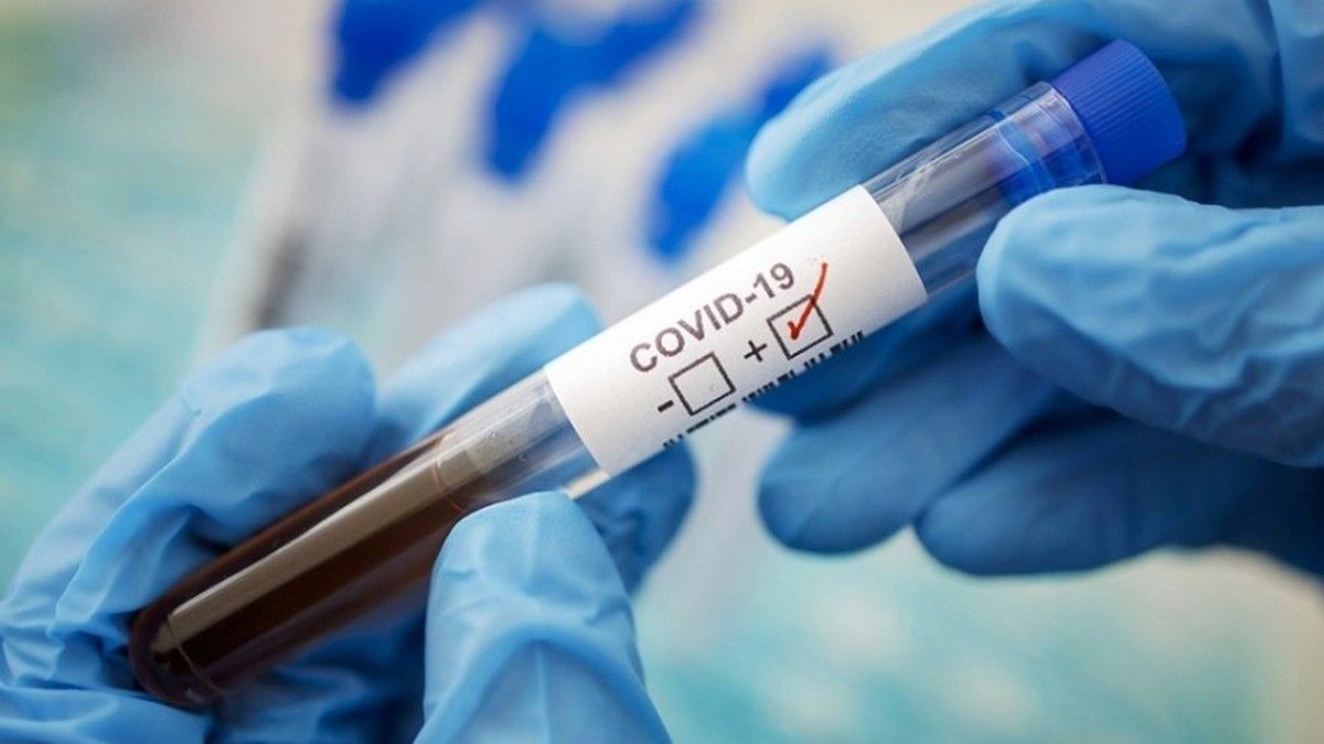 COVID-19 в Днепре и области: за сутки выздоровел 651 человек