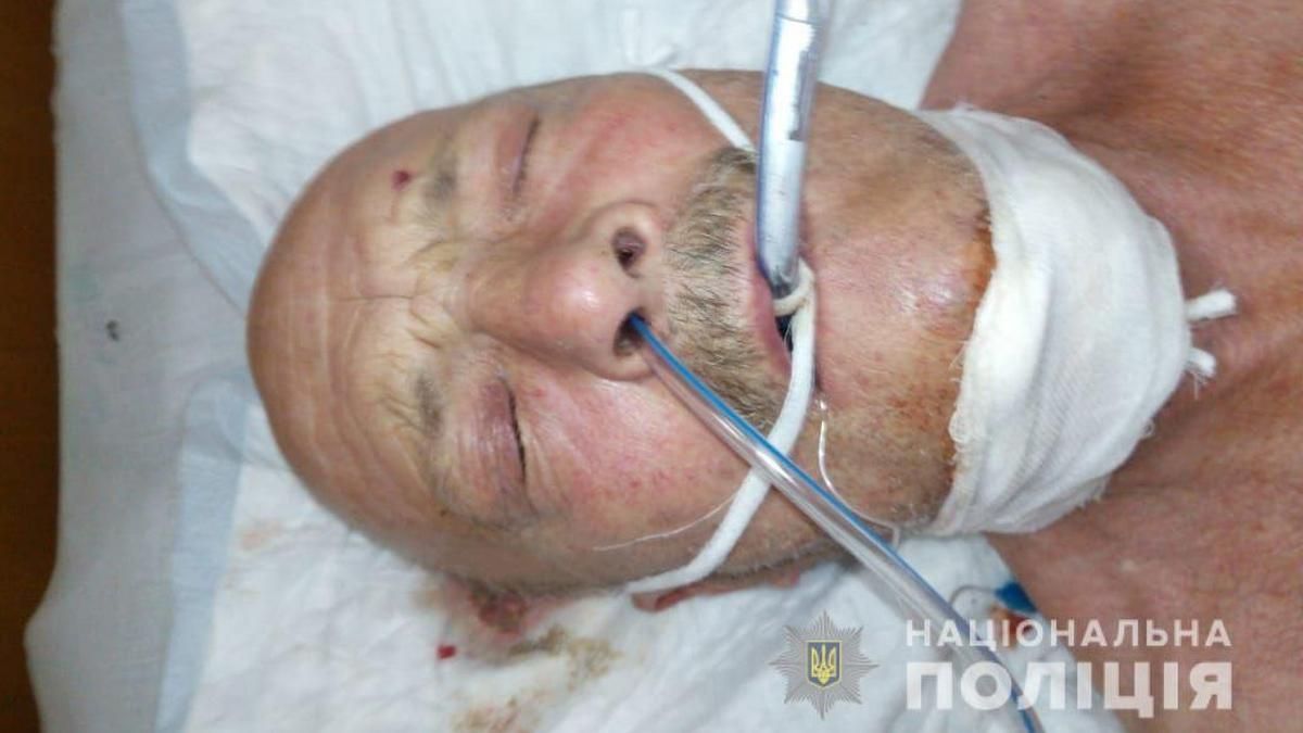 В Днепропетровской области в реанимацию доставили мужчину: помогите найти родственников