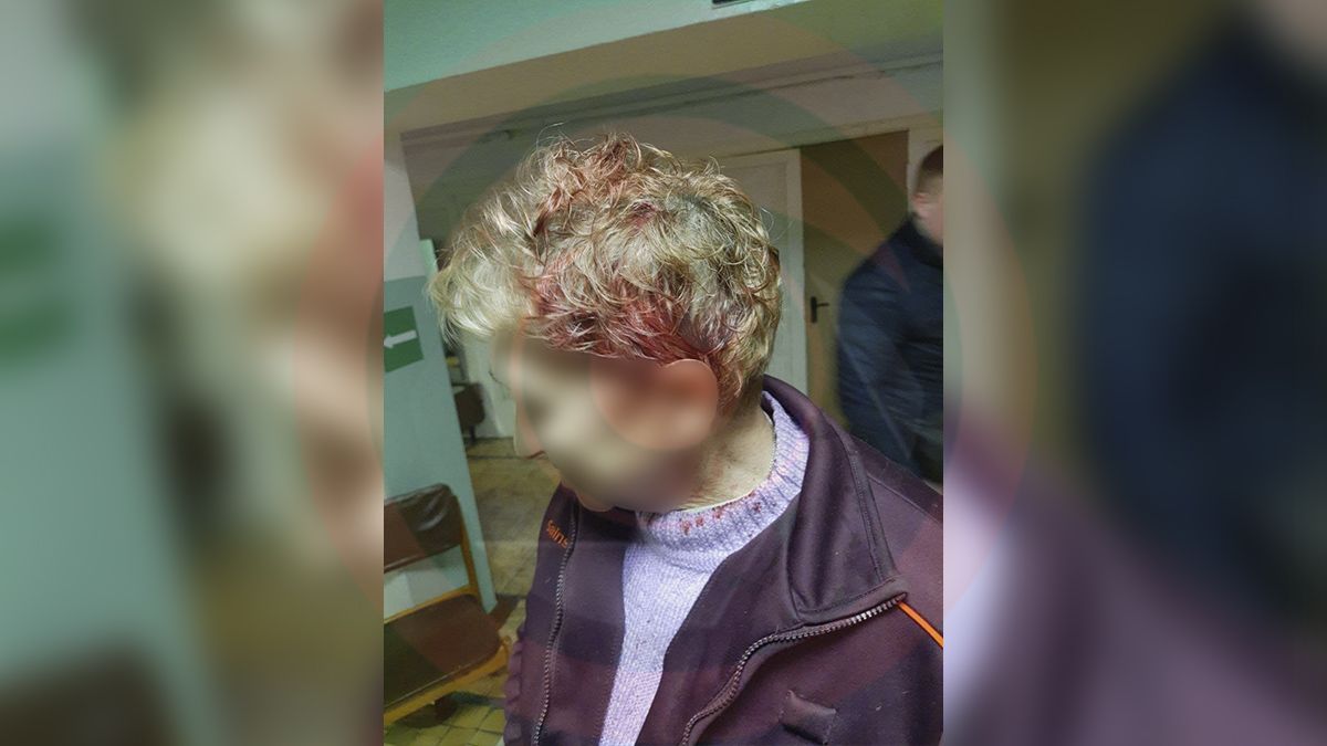 В Днепре на Поля мужчина ударил молотком по голове вахтерку общежития