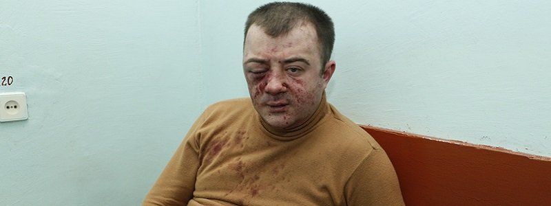 Неоднократные угрозы и бездействие полиции: подробности нападения на юриста в Днепре (ФОТО, ВИДЕО)